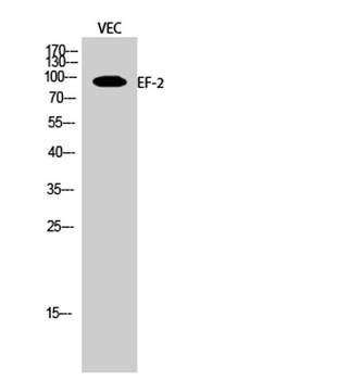 EF-2 rabbit pAb Antibody