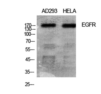 EGFR rabbit pAb Antibody