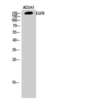 EGFR rabbit pAb Antibody