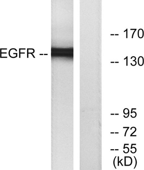 EGFR rabbit pAb Antibody