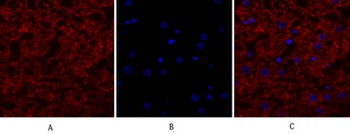 EGFR rabbit pAb Antibody
