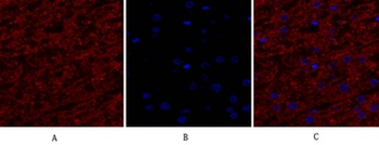 EGFR rabbit pAb Antibody