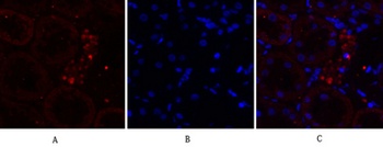 EGFR rabbit pAb Antibody