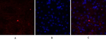 EGFR rabbit pAb Antibody