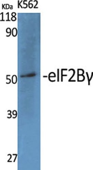 eIF2Bγ rabbit pAb Antibody