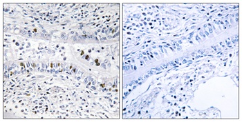 ENX-2 rabbit pAb Antibody