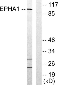 EphA1 rabbit pAb Antibody