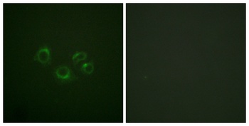 EphA2/3/4 rabbit pAb Antibody