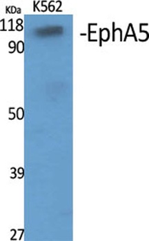 EphA5 rabbit pAb Antibody