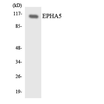 EphA5 rabbit pAb Antibody