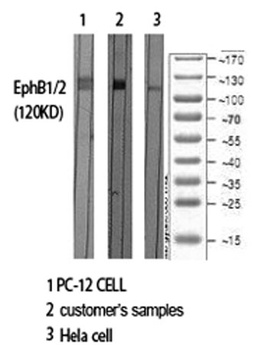 EphB1/2 rabbit pAb Antibody