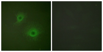 EphB1/2 rabbit pAb Antibody