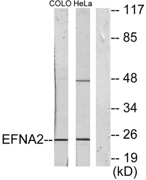 Ephrin-A2 rabbit pAb Antibody