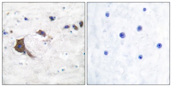 ERAB rabbit pAb Antibody