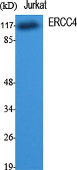 ERCC4 rabbit pAb Antibody