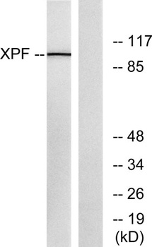 ERCC4 rabbit pAb Antibody