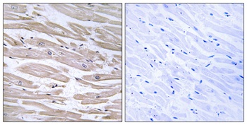ERdj3 rabbit pAb Antibody