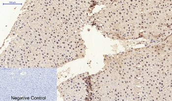 ERβ rabbit pAb Antibody