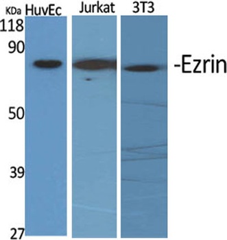 Ezrin rabbit pAb Antibody