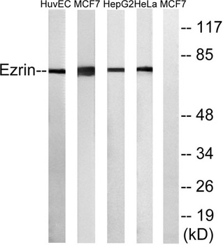Ezrin rabbit pAb Antibody