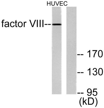 Factor VIII rabbit pAb Antibody