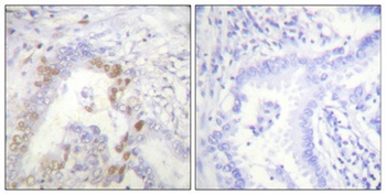 FANCD2 rabbit pAb Antibody