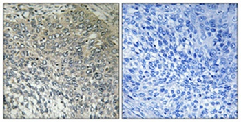 FASTKD3 rabbit pAb Antibody