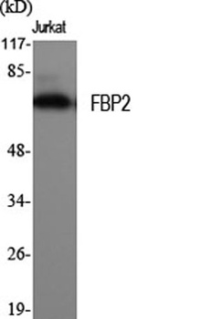 FBP2 rabbit pAb