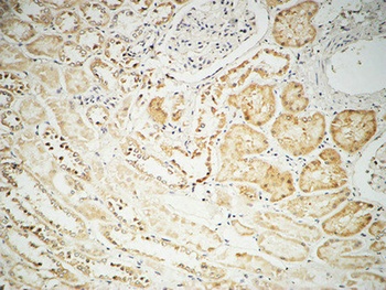 Fhit rabbit pAb Antibody