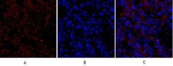 Flk-1/VEGFR2 rabbit pAb Antibody