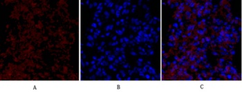 Flk-1/VEGFR2 rabbit pAb Antibody