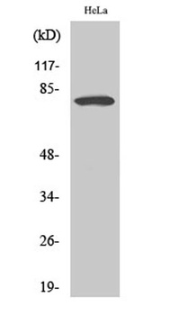 FoxO1A rabbit pAb Antibody
