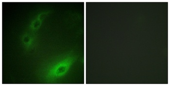 FoxO1A rabbit pAb Antibody