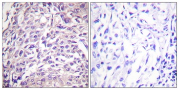 FoxO1A rabbit pAb Antibody