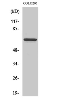 FoxO4 rabbit pAb Antibody