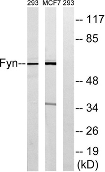 Fyn rabbit pAb Antibody