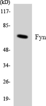 Fyn rabbit pAb Antibody