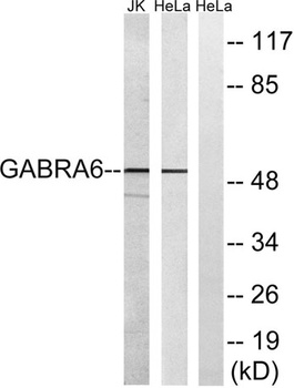 GABAA Rα6 rabbit pAb Antibody