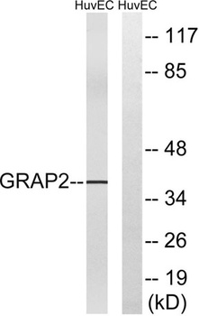 Gads rabbit pAb Antibody