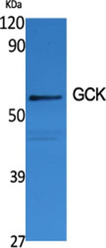 GCK rabbit pAb Antibody