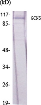 GCN5 rabbit pAb Antibody