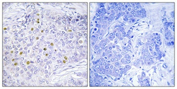 GCN5 rabbit pAb Antibody