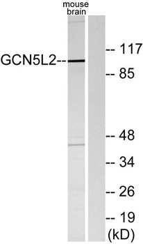 GCN5 rabbit pAb Antibody