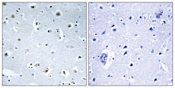 GCP3 rabbit pAb Antibody