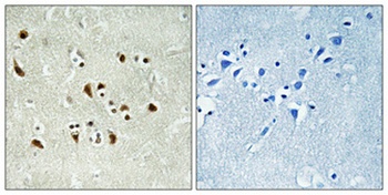 GCP6 rabbit pAb Antibody