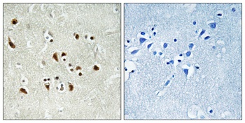 GCP6 rabbit pAb Antibody