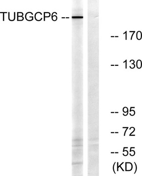 GCP6 rabbit pAb Antibody