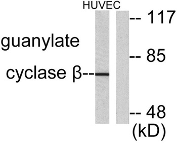 GCS-β-1 rabbit pAb Antibody