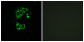 GIMAP2 rabbit pAb Antibody