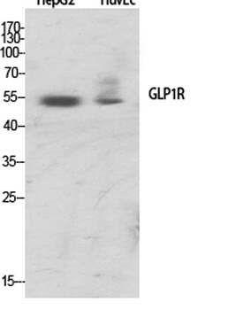 GLP-1R rabbit pAb Antibody